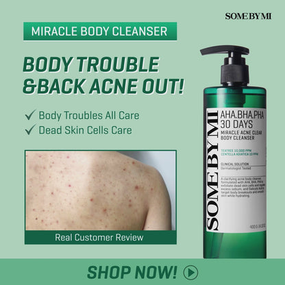 SOME BY MI - AHA, BHA, PHA 30 Days Miracle Acne Clear Body Cleanser